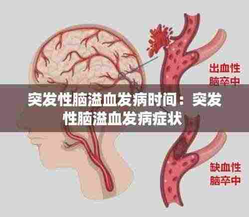 突发性脑溢血发病时间:突发性脑溢血发病症状