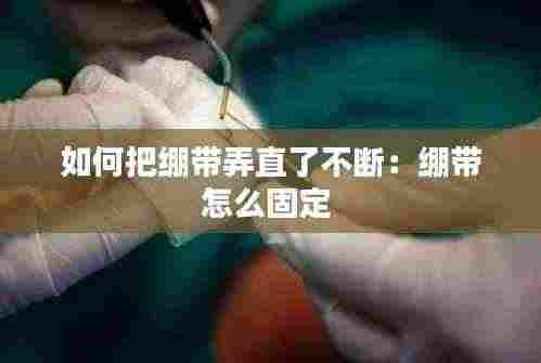 如何把绷带弄直了不断:绷带怎么固定