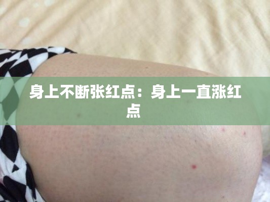 身上不断张红点：身上一直涨红点 